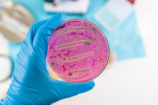 Examine bacteria in petri dishes in the laboratory. Selective focus. nature.