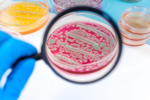Examine bacteria in petri dishes in the laboratory. Selective focus. nature.