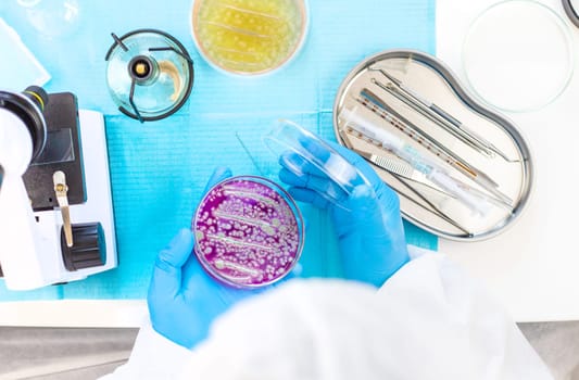 Examine bacteria in petri dishes in the laboratory. Selective focus. nature.