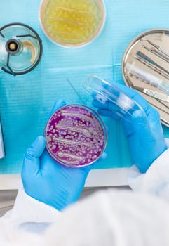 Examine bacteria in petri dishes in the laboratory. Selective focus. nature.