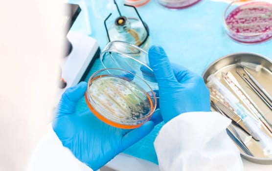 Examine bacteria in petri dishes in the laboratory. Selective focus. nature.