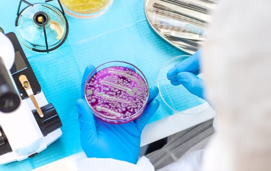 Examine bacteria in petri dishes in the laboratory. Selective focus. nature.