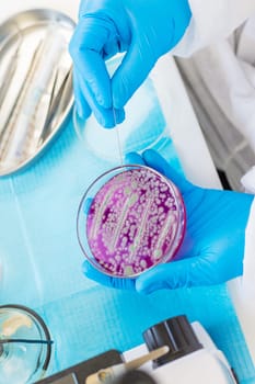 Examine bacteria in petri dishes in the laboratory. Selective focus. nature.
