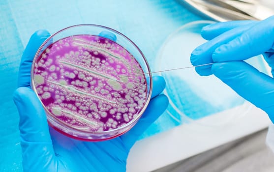 Examine bacteria in petri dishes in the laboratory. Selective focus. nature.