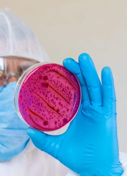 Examine bacteria in petri dishes in the laboratory. Selective focus. nature.