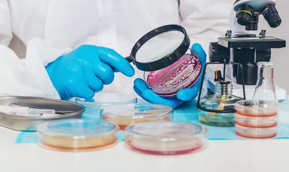 Examine bacteria in petri dishes in the laboratory. Selective focus. nature.