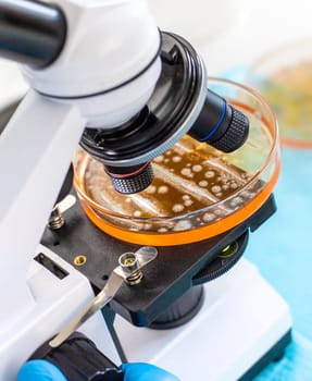 Examine bacteria in petri dishes in the laboratory. Selective focus. nature.