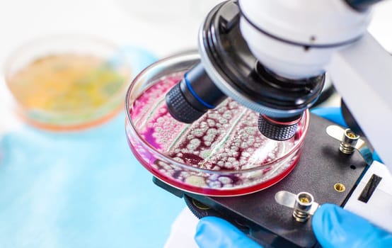 Examine bacteria in petri dishes in the laboratory. Selective focus. nature.