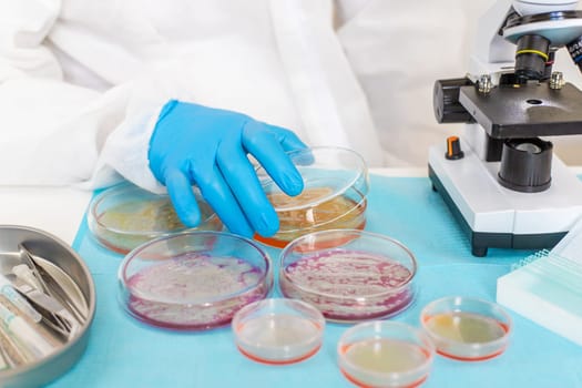 Examine bacteria in petri dishes in the laboratory. Selective focus. nature.