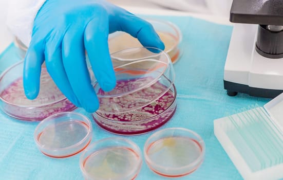 Examine bacteria in petri dishes in the laboratory. Selective focus. nature.
