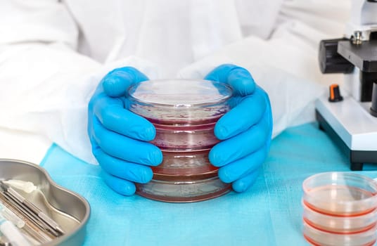 Examine bacteria in petri dishes in the laboratory. Selective focus. nature.