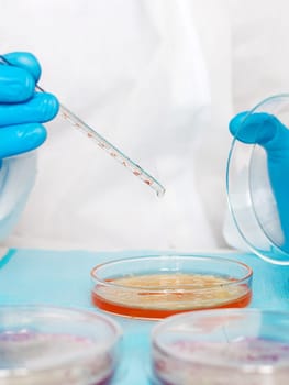 Examine bacteria in petri dishes in the laboratory. Selective focus. nature.