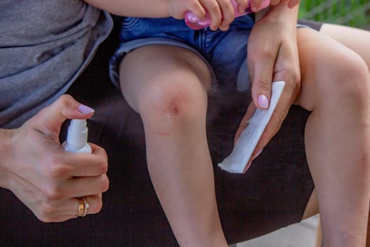 Scratches on a child's leg. small child
