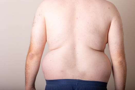 A man with a large belly is standing in front of a white wall. The man's back is showing, and his belly is clearly visible. Concept of discomfort and self-consciousness