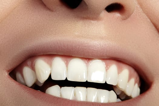 Closeup Dental Beauty. Beautiful Macro with perfect White Teeth. Fashion Naturel Lips Make-up. Whitening Tooth and Wellness Treatment