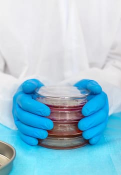 Examine bacteria in petri dishes in the laboratory. Selective focus. nature.