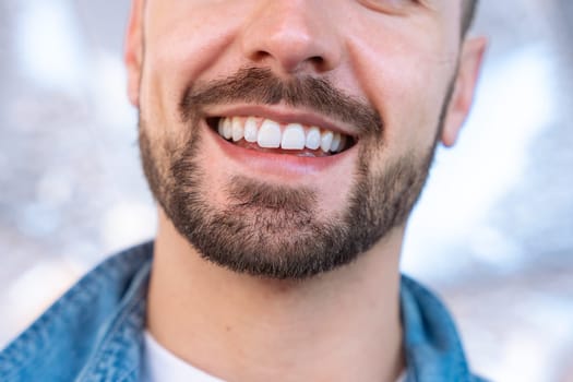 Close-up portrait of a smiling young man showing his perfect white teeth. His trimmed beard and joyful expression convey confidence, happiness, and charm in a bright and casual atmosphere.