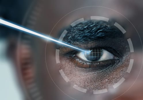 A detailed view of a person's eye during a high-tech examination procedure aimed at improving vision clarity through laser technology in a clinical setting.