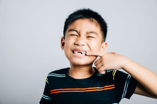 Asian boy showcasing dentistry pointing to missing front tooth. Health care concept isolated on white background emphasizing child dental growth and care. Children show teeth gap, dentist problems