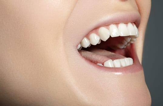 Closeup Dental Beauty. Beautiful Macro with perfect White Teeth. Fashion Naturel Lips Make-up. Whitening Tooth and Wellness Treatment