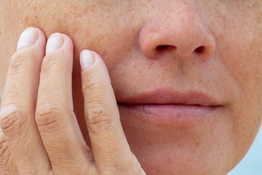 Close-up of woman touching her cheek with fingers showing natural skin texture and freckles