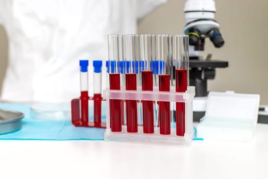 examine blood in the laboratory. Selective focus. medicine.