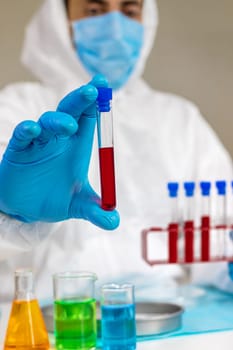 examine blood in the laboratory. Selective focus. medicine.