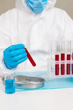 examine blood in the laboratory. Selective focus. medicine.