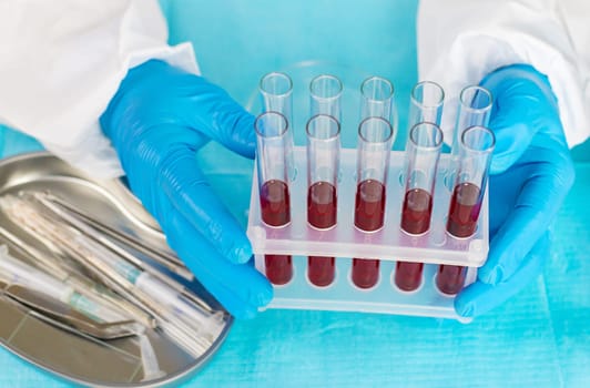 examine blood in the laboratory. Selective focus. medicine.