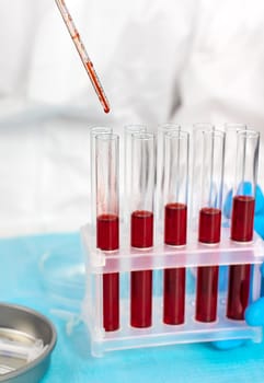 examine blood in the laboratory. Selective focus. medicine.