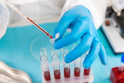 examine blood in the laboratory. Selective focus. medicine.
