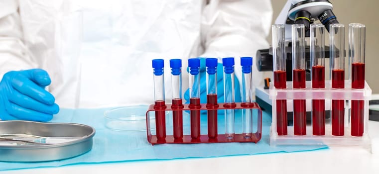examine blood in the laboratory. Selective focus. medicine.