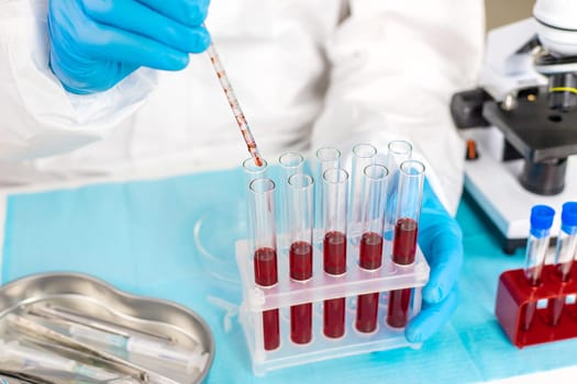 examine blood in the laboratory. Selective focus. medicine.