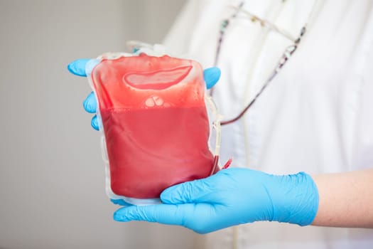 Blood plasma in the center of transfusiology and donation. close up the blood bag in the laboratory in the hands.