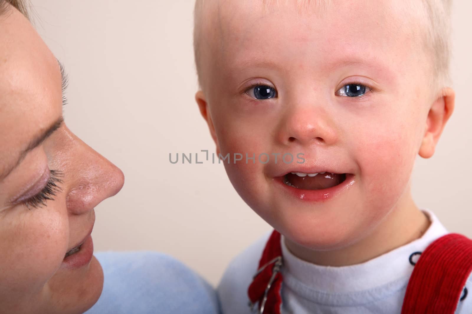 A closeup portrait view of a young boy with Down Syndrome and his mother.
