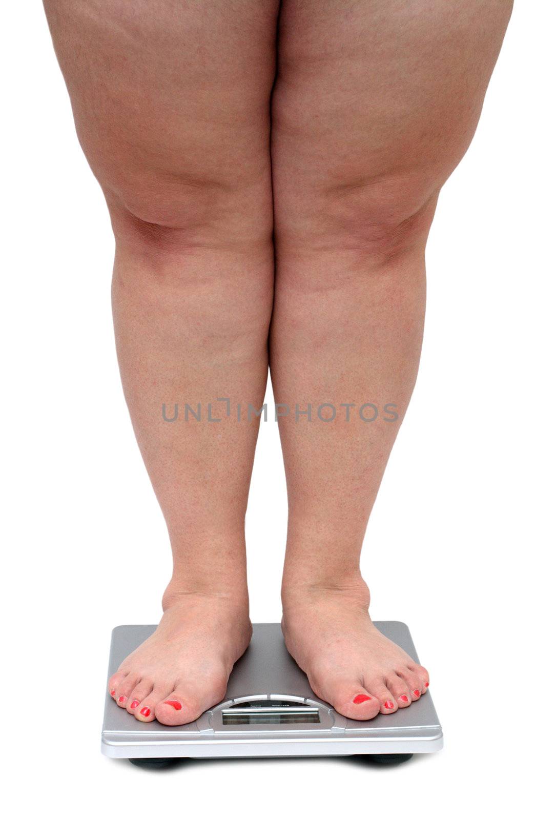 women legs with overweight by Mikko