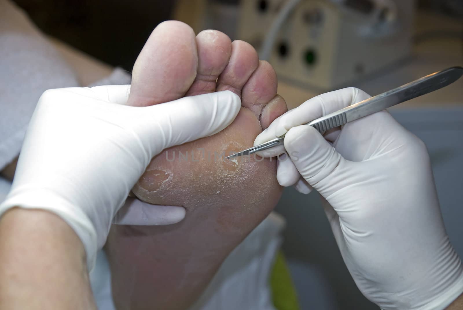 A pedicure removing hard skin with a knife from a client's feet