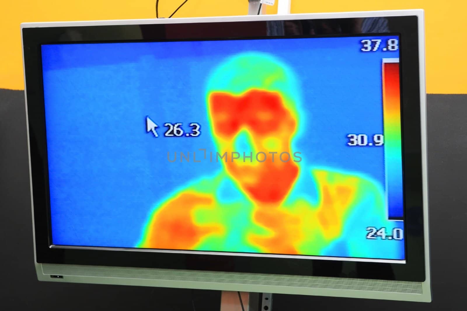  	Thermographic camera