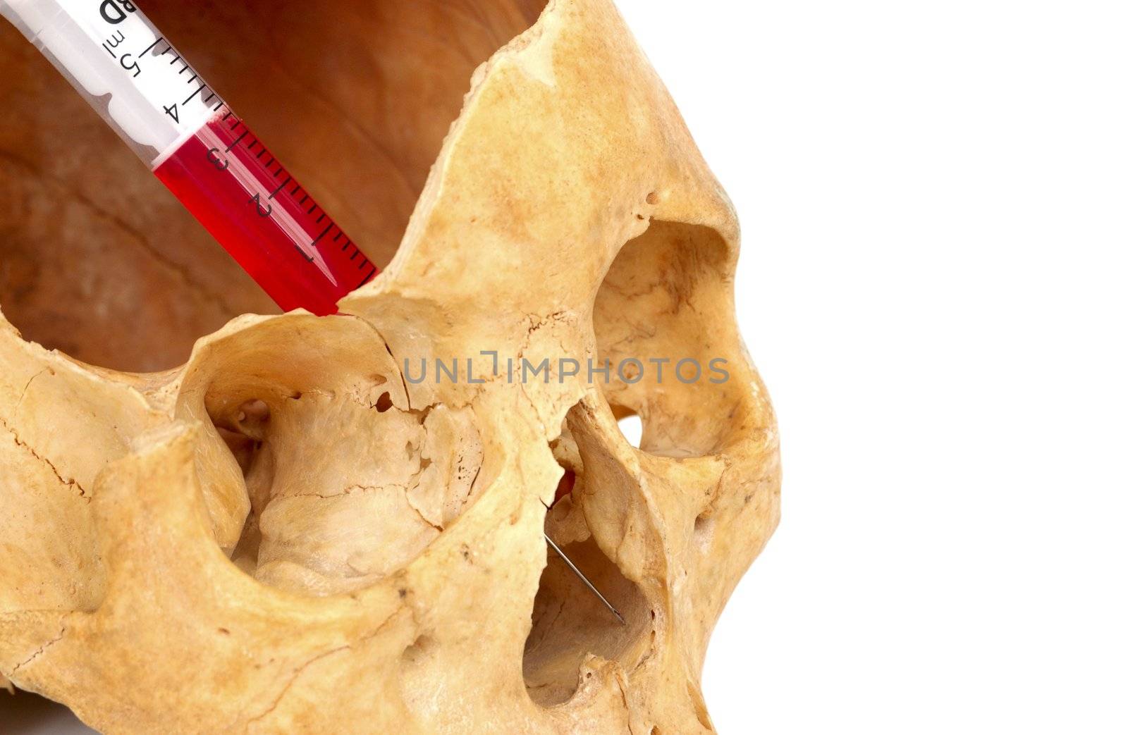 Old broken skull against white background with syringe with red liquid