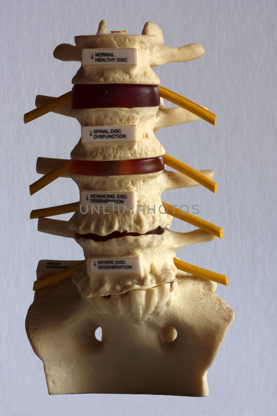 Model of a human spine


Model of part of the human spine