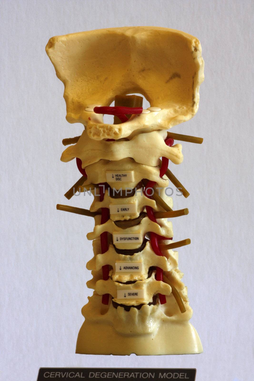 Human Spine by Imagecom
