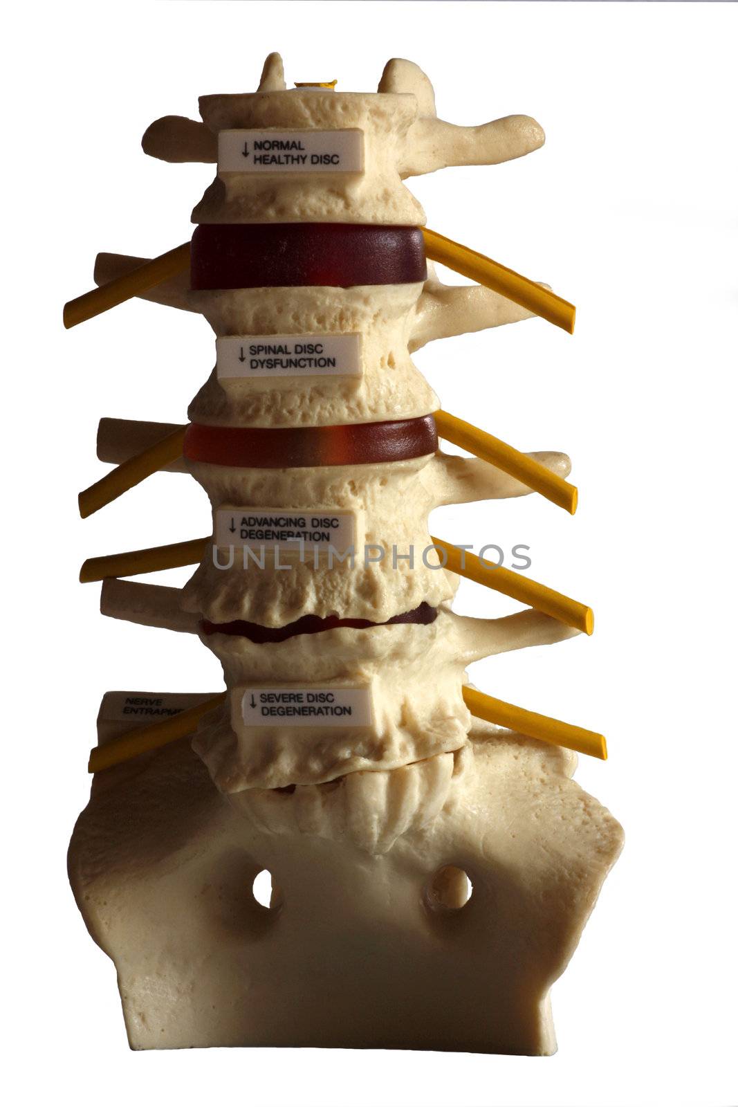 Part of the human spine model