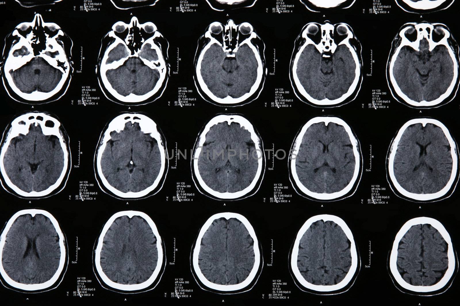 details Magnetic resonance of a brain