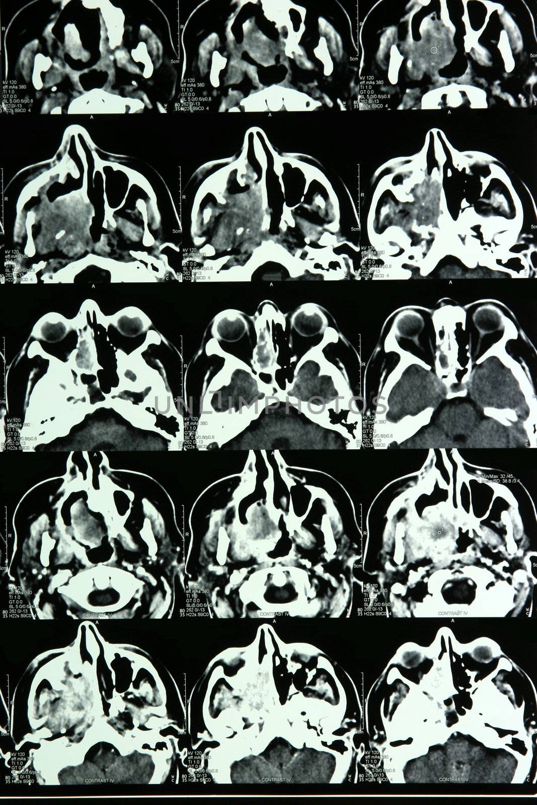 details Magnetic resonance of a brain