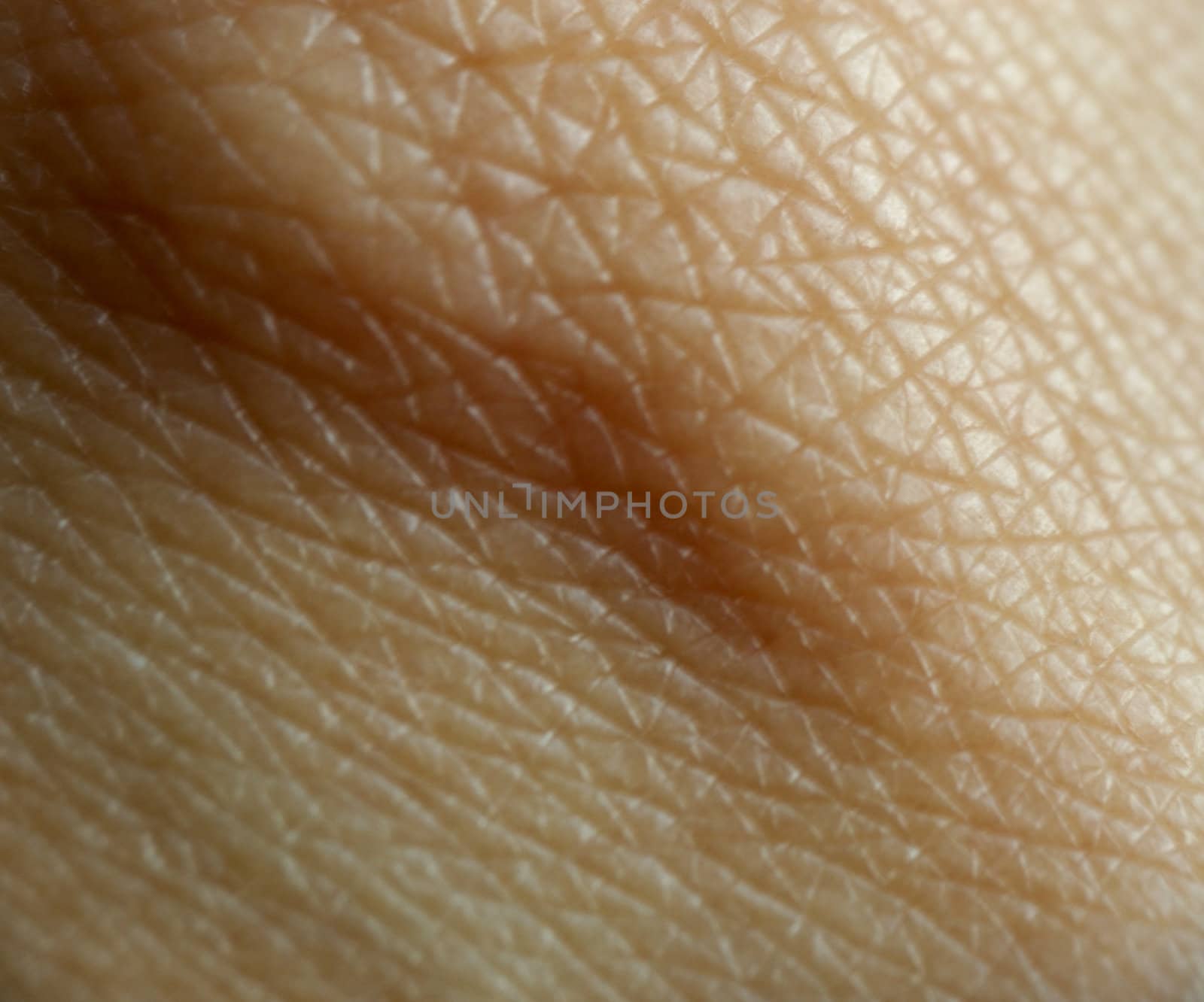 human skin by mettus