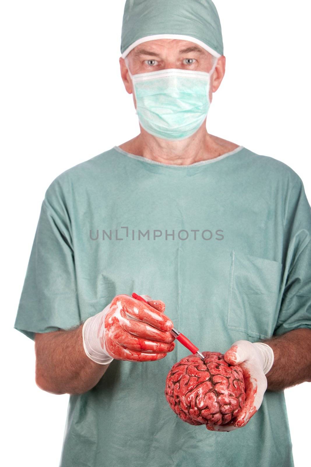 A 60 year old surgeon pointing to a bloody brain.