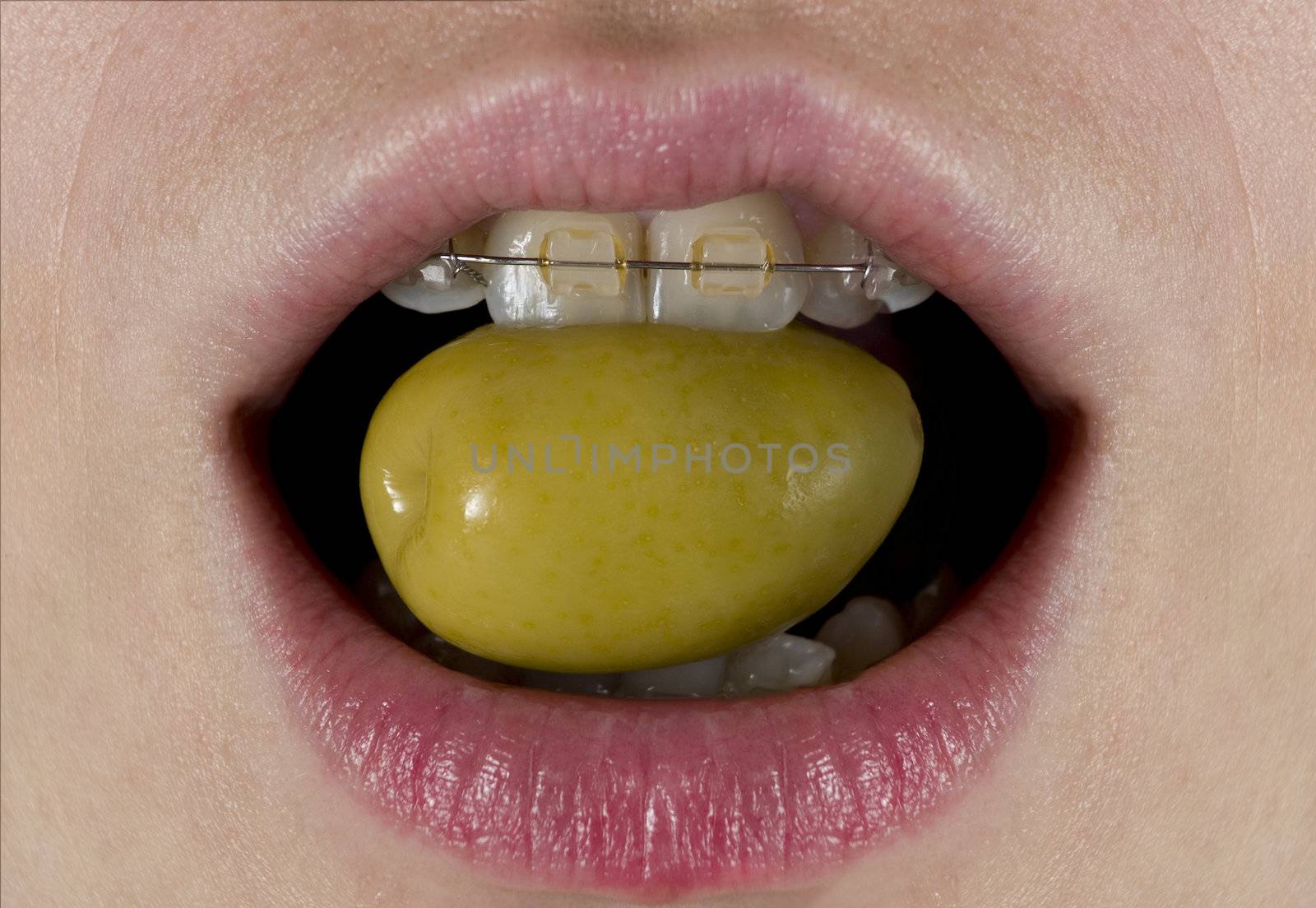 A green olive about to be eaten for a woman with braces.