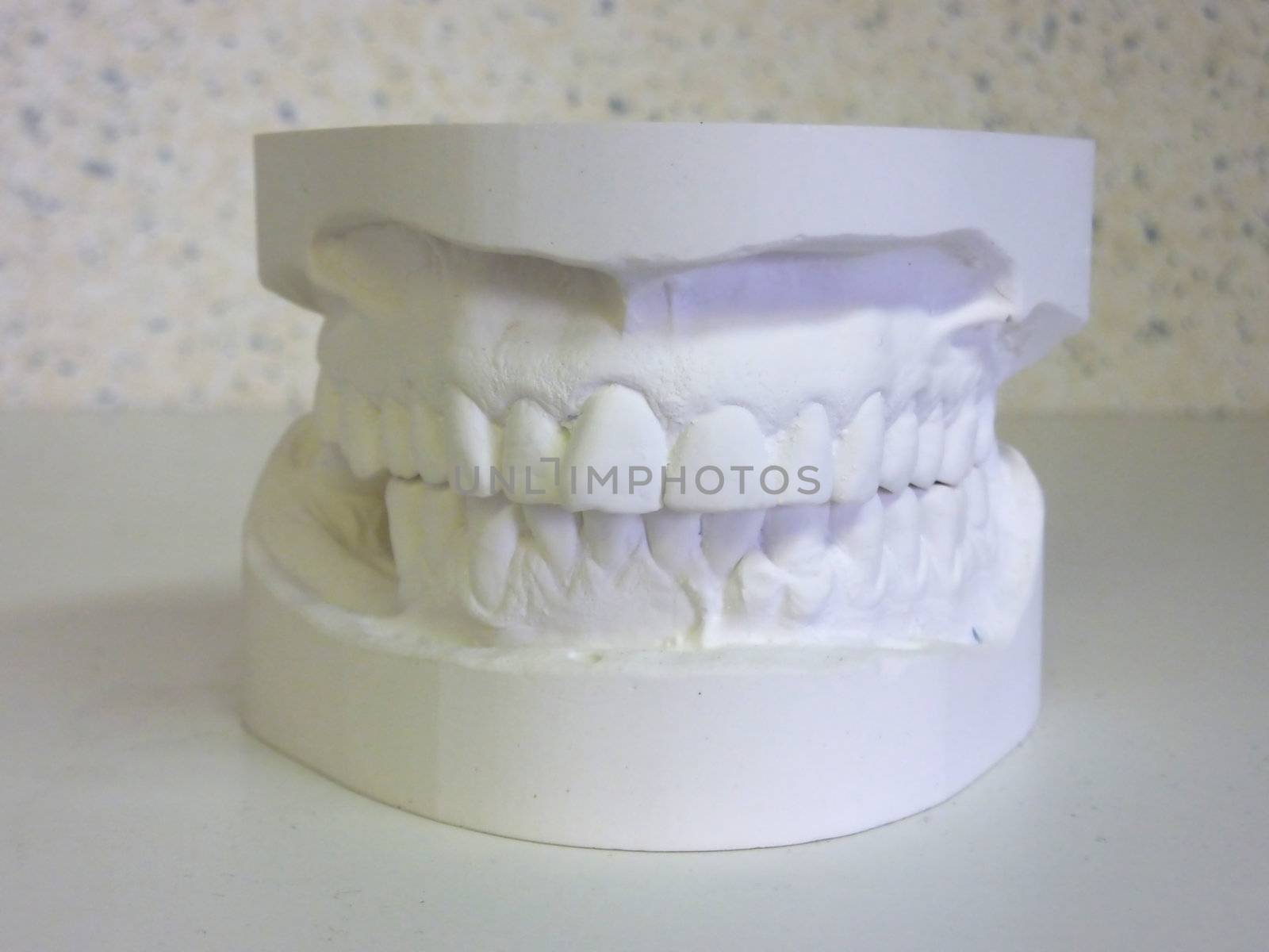 White plaster upper and lower teeth figuring a mouth