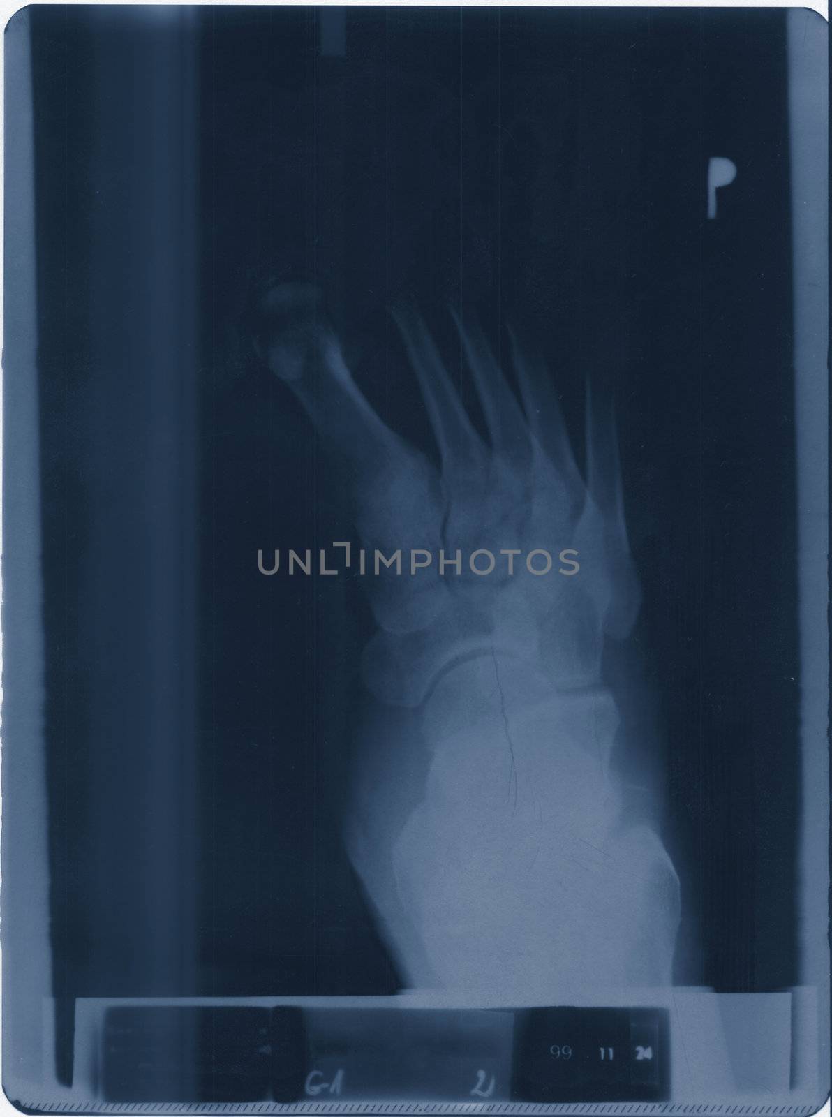 x-ray by iwka