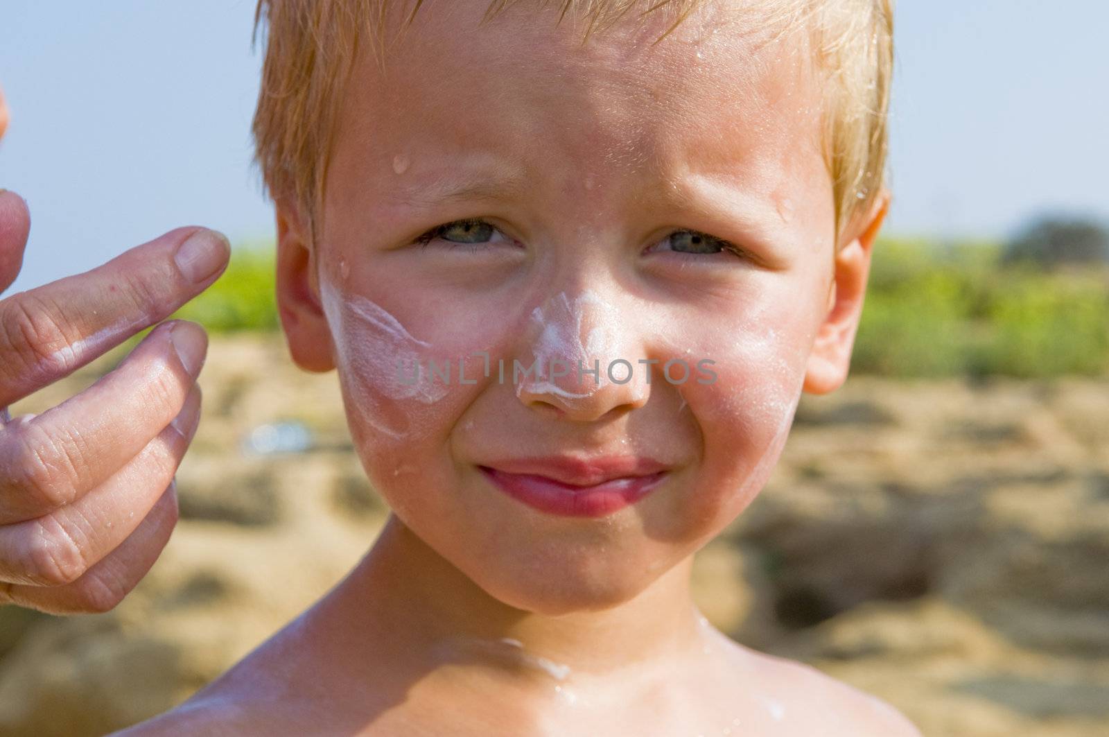 The boy smear with a cream from sunburn